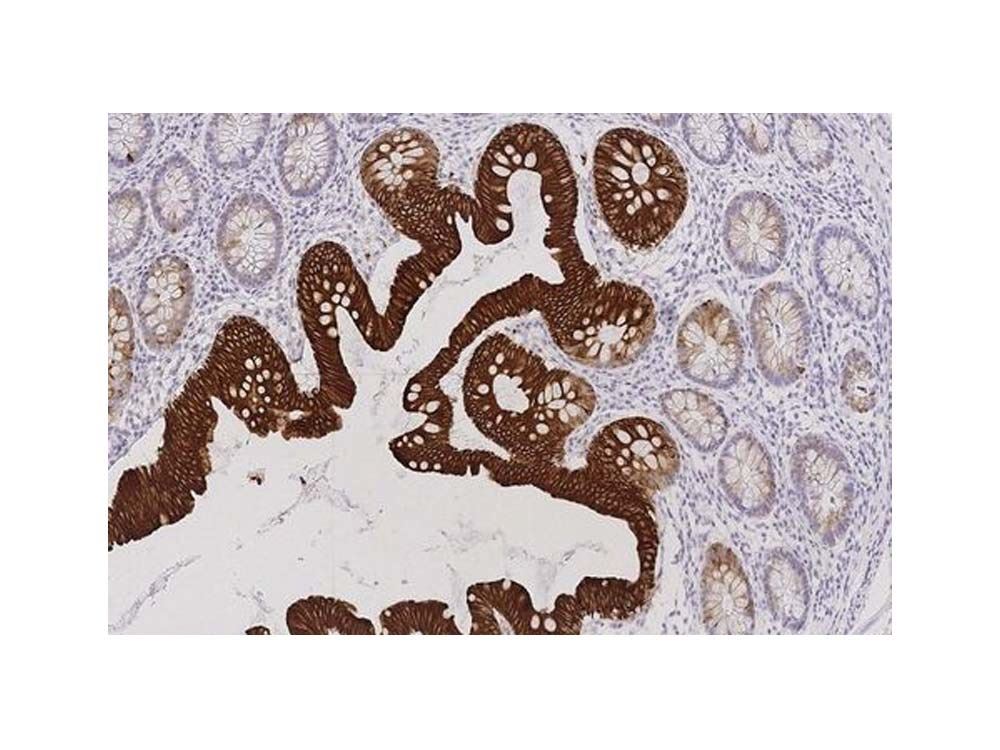 Novocastra HD - Neuropathology