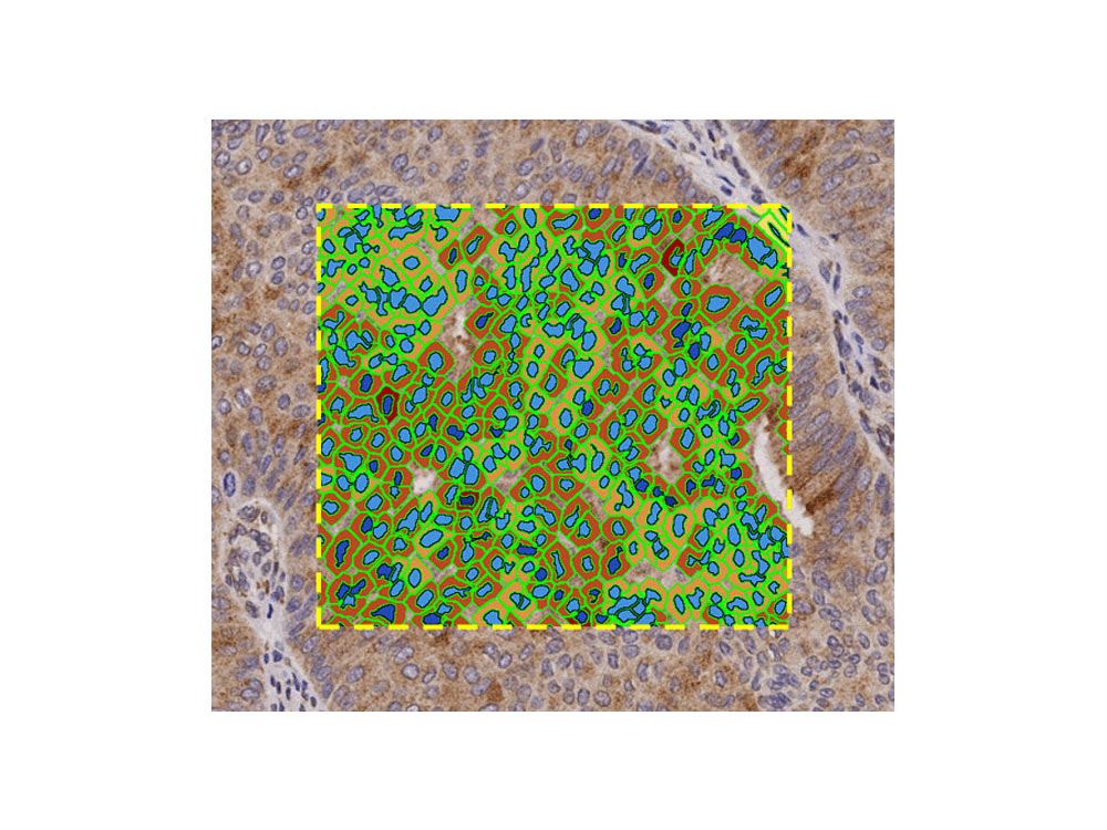 Image Analysis Solutions