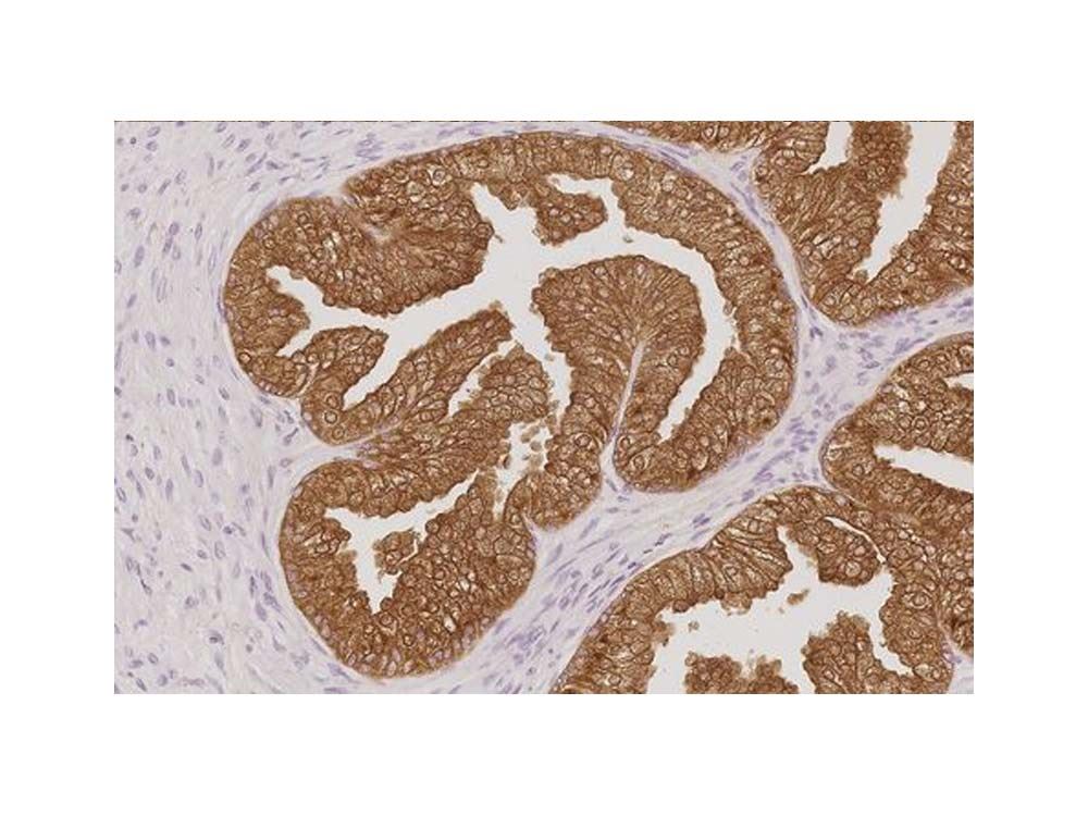 Novocastra HD – Uropathology