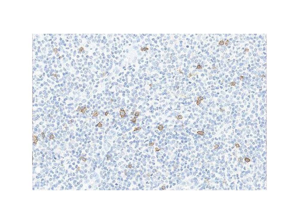 Novocastra HD – Pulmonary