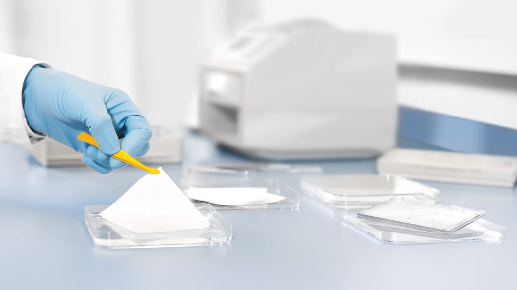 Blotting Paper & Membranes – Technoscient