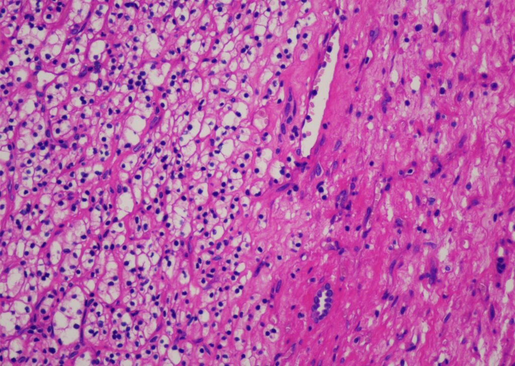 Hematoxylin-Eosin staining solution (H-E)