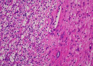 Hematoxylin-Eosin staining solution (H-E)