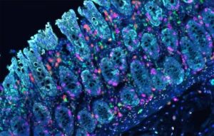 Pathology Specimen Traceability System