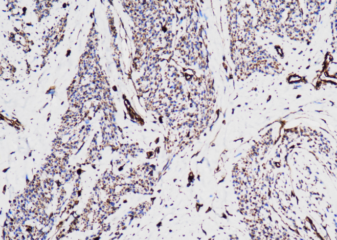 Vimentin